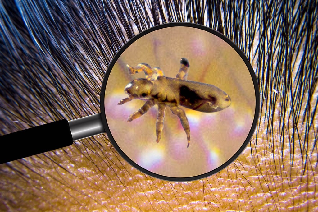 How To Get Rid of Lice In Your House? LiceDoctors